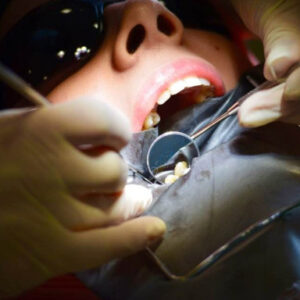 teethjawoperation-sachindental