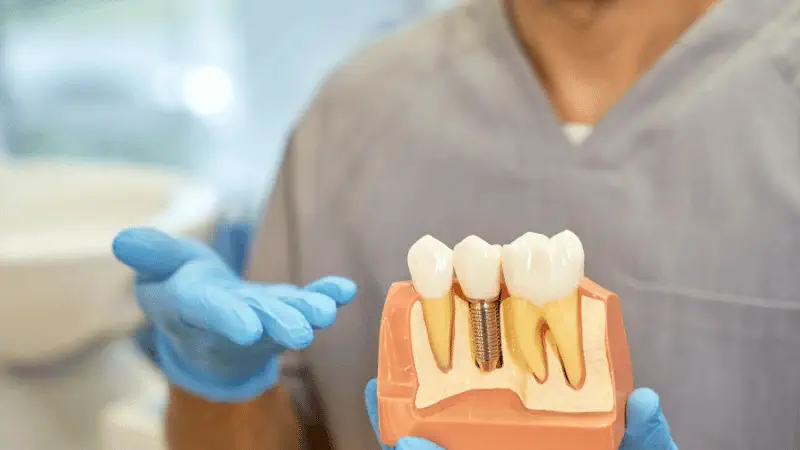 Different types of dental implant