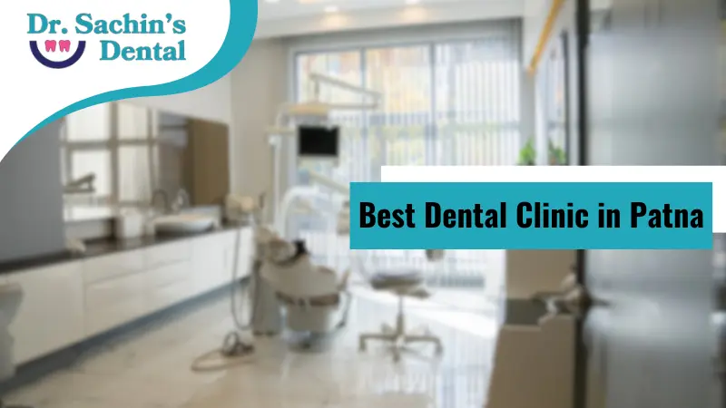 Best dental clinic in patna