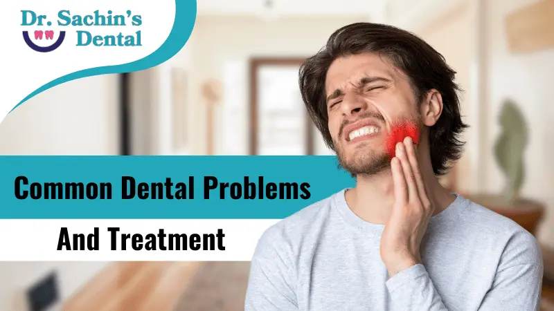 Common Dental Problems and treatment