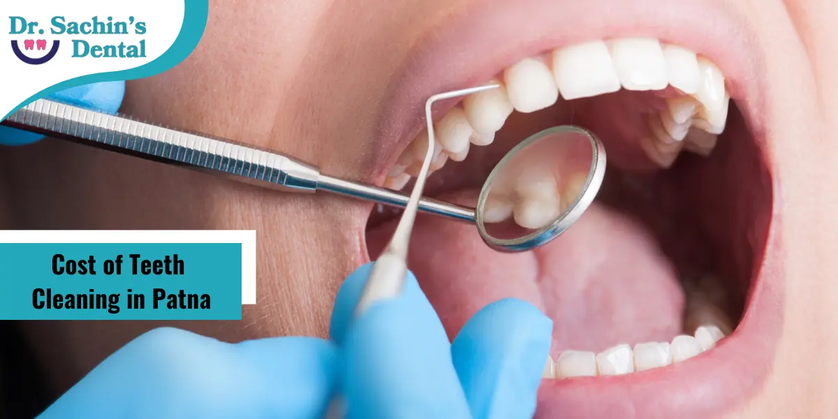 Cost of Teeth Cleaning in Patna