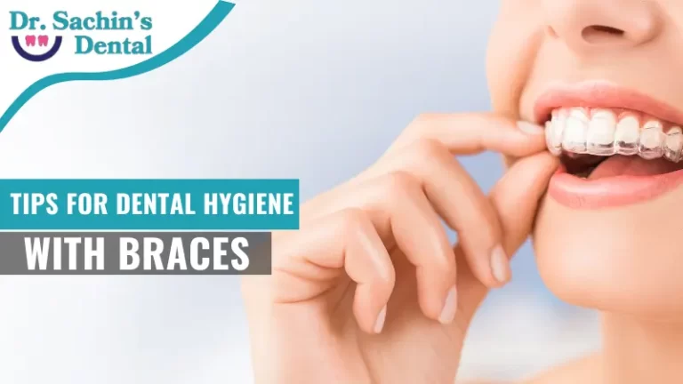 Tips for Dental Hygiene with Braces