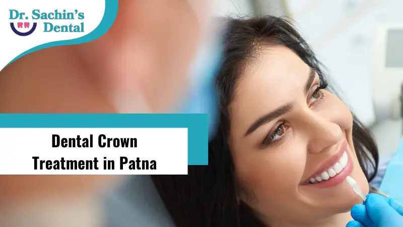 Dental Crown Treatment in Patna