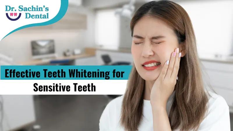 Effective Teeth Whitening for Sensitive Teeth