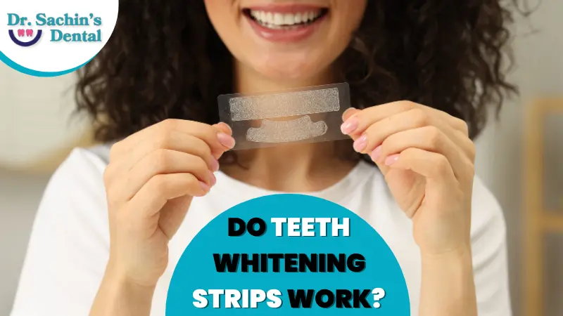 Do Teeth Whitening Strips Work