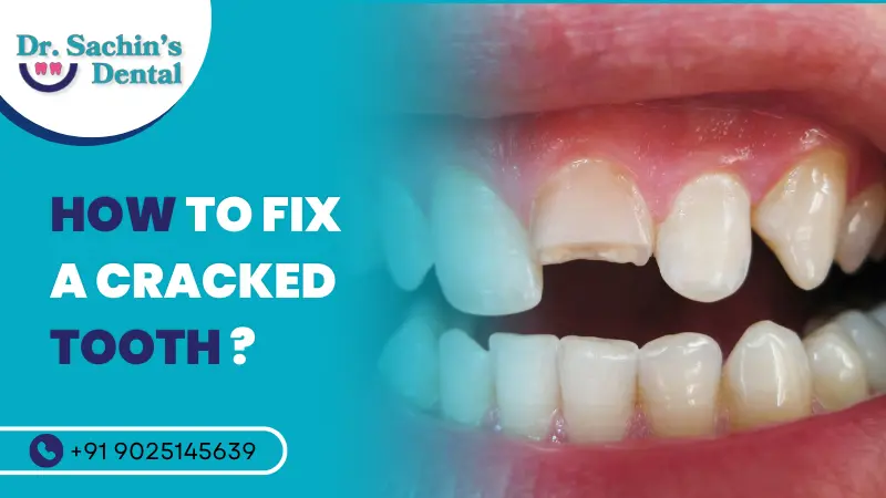 How to Fix a Cracked Tooth