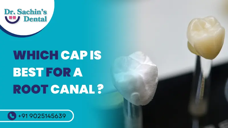 Which cap is best for root canal