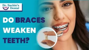 Do Braces Weaken Teeth