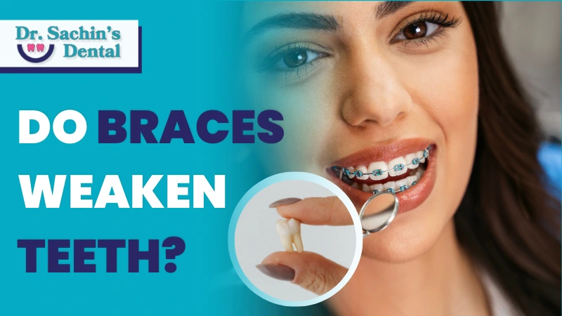 Do Braces Weaken Teeth