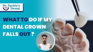 What To Do If My Dental Crown Falls Out