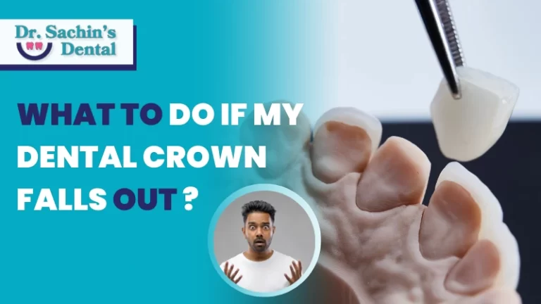 What To Do If My Dental Crown Falls Out