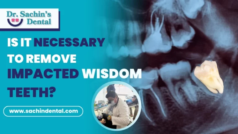 is it necessary to remove impacted wisdom teeth