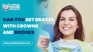 can you get braces with crowns and bridges