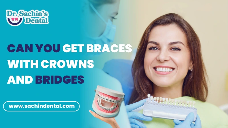 can you get braces with crowns and bridges