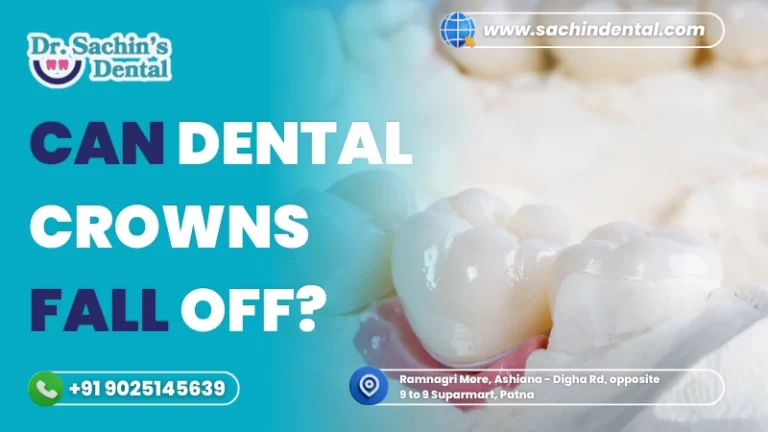 Can Dental Crowns Fall Off