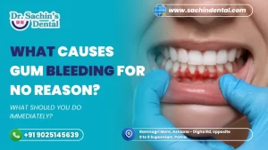 What causes gum bleeding for no reason