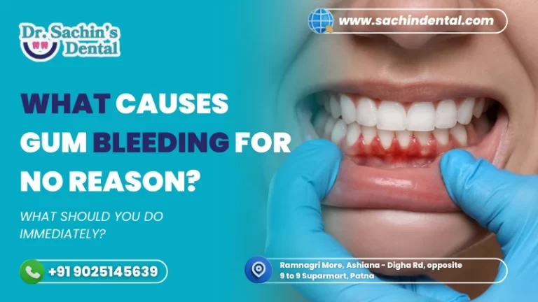 What causes gum bleeding for no reason