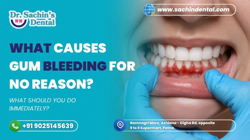 What causes gum bleeding for no reason