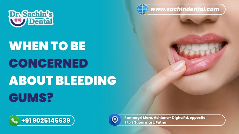 When to be concerned about bleeding gums