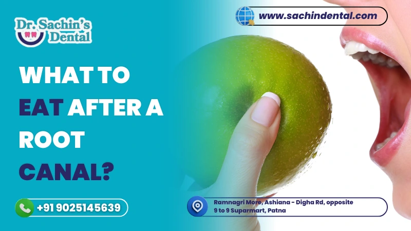 What to Eat After a Root Canal