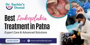 Best Leukoplakia Treatment in Patna