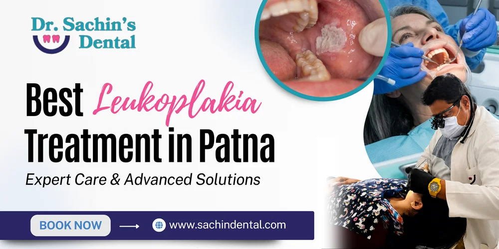 Best Leukoplakia Treatment in Patna