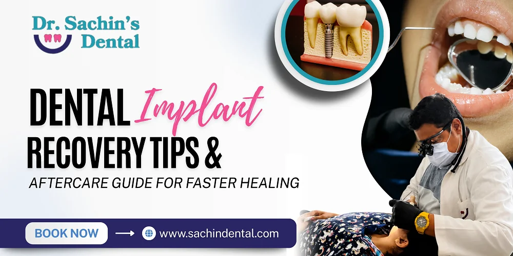 Dental Implant Recovery Tips
