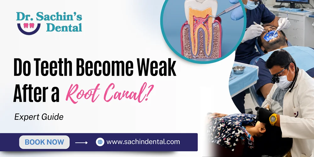 Do Root Canal Teeth Become Weak