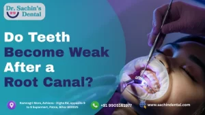 Do Teeth Become Weak After a Root Canal