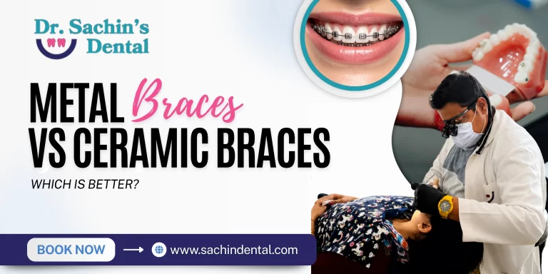 Metal Braces vs Ceramic Braces