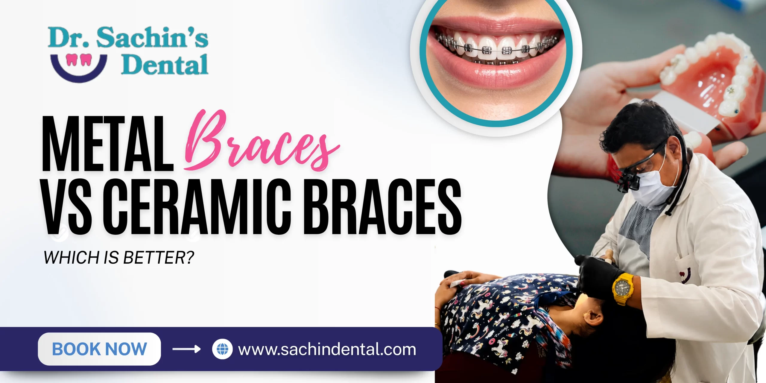 Metal Braces vs Ceramic Braces