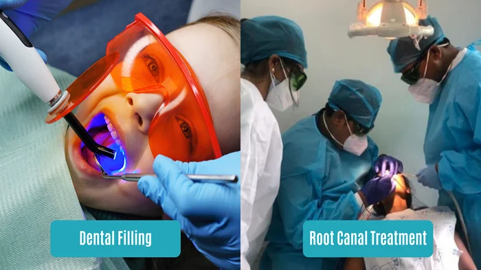 Dental Filling and Root Canal Treatment