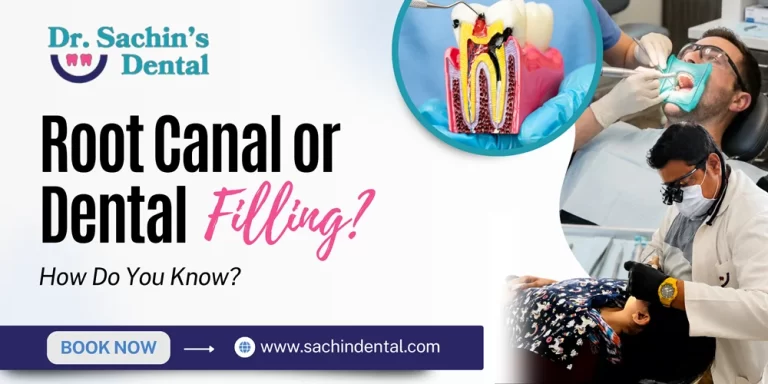 How Do I Know If I Need a Root Canal or a Filling