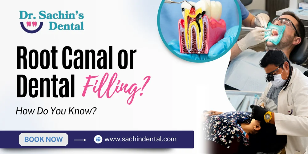 How Do I Know If I Need a Root Canal or a Filling