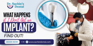 What Happens if I Don't Get an Implant