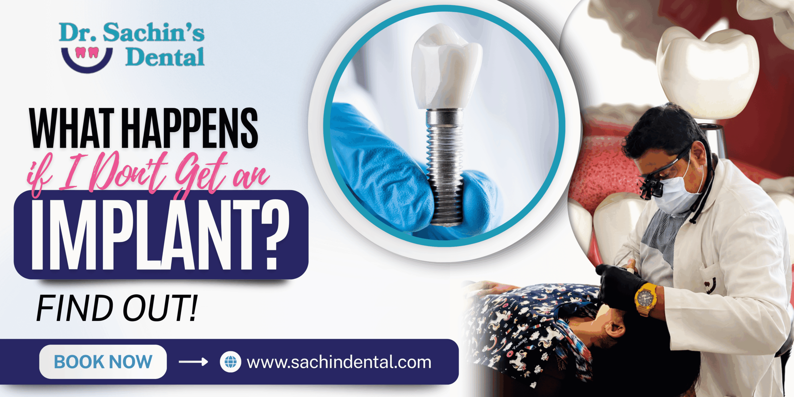 What Happens if I Don't Get an Implant