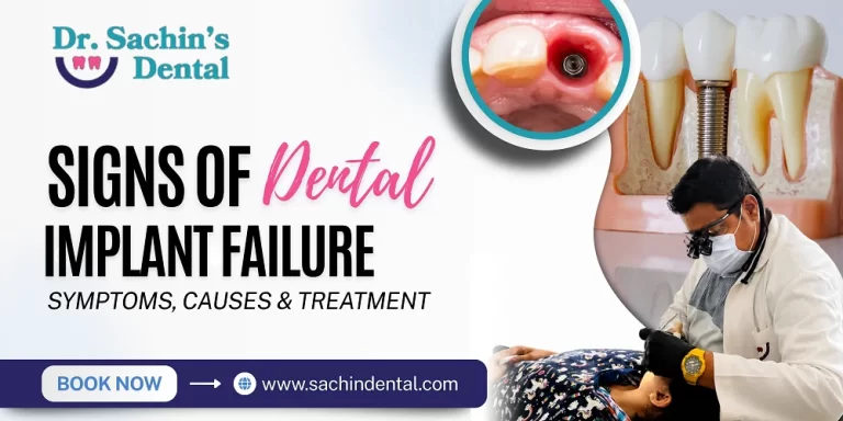 dental implant failure