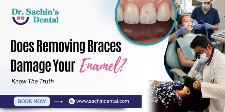 Enamel damage from braces removal