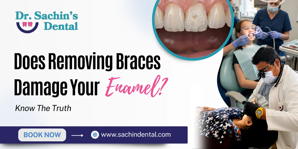 Enamel damage from braces removal