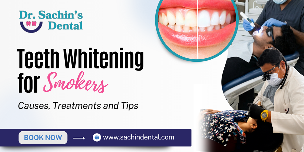Teeth Whitening for Smokers